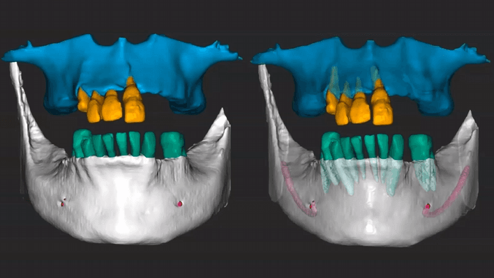 CBCT Technology: What Really Matters When Making Your Purchase Decision