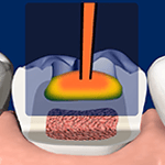 Raising the Bar with a New Technology in Warm Composites