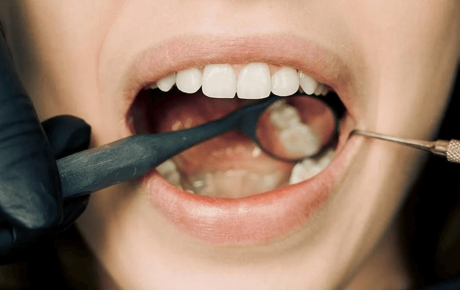 Wellness Dentistry: Connecting Oral Health with General Health