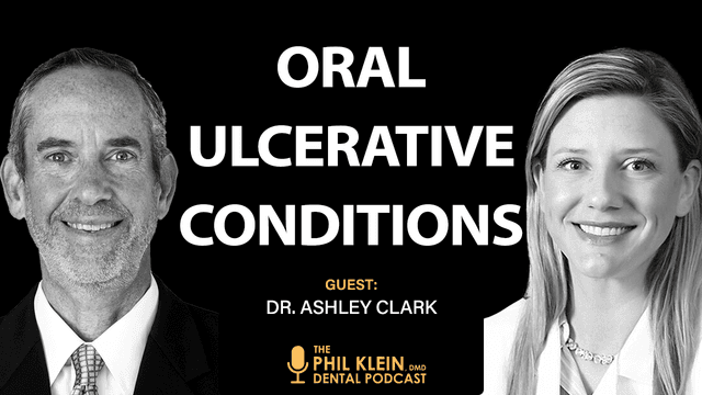 Navigating Oral Ulcerative Conditions: When to Treat, Refer, or Reassure